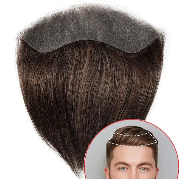 Front Hair Patch || Front Patti