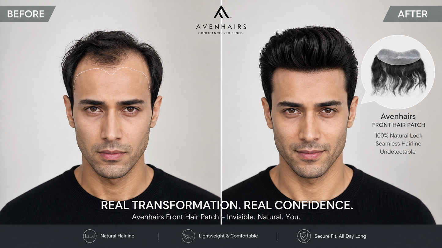 Front Hair Patch | Avenhairs
